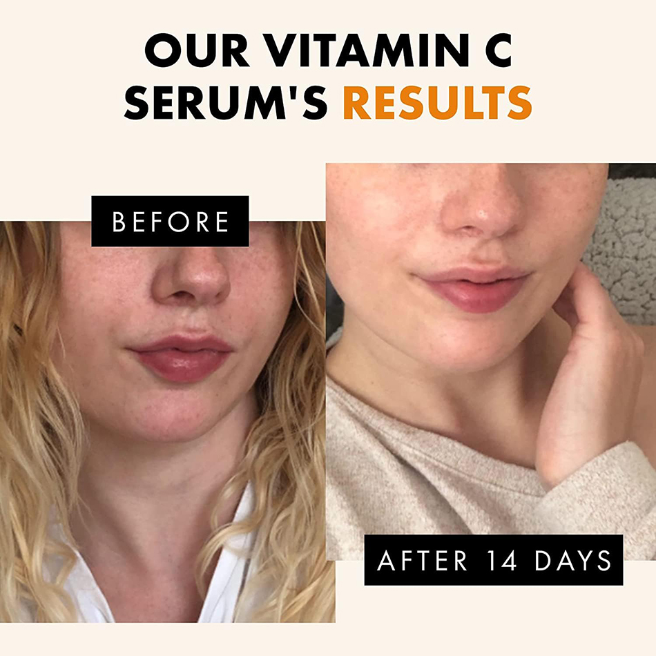 Super 120ml Vitamin C Serum An - đánh giá và giá Vitamin C Serum Face